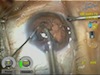 Using Peristaltic and Venturi Pumps