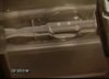 Astigmatic Reduction: Toric IOL - Part 2