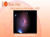 Core Vitrectomy and Induction of PVD
